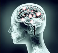 Neuro Physiotherapy